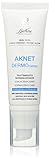 Bionike Aknet - Dermocontrol Trattamento Viso Normalizzante con Acido Glicolico, per Pelli a...