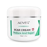 Crema Avanzata Scar cream Trattamento Rimuovere Cicatrici Chirurgiche, Acne Veloce Efficace Su...