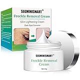 Anti Macchie Viso Crema,Crema Sbiancante,Whitening Cream,Tono della pelle irregolare, macchie scure...