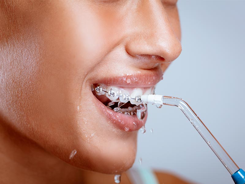 Idropulsori dentali professionali