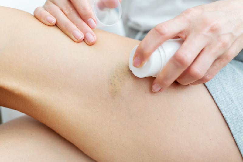 crema antibiotica per ferite migliore