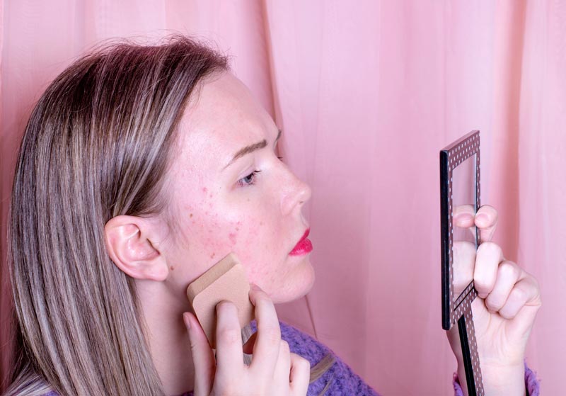 fondotinta per acne caratteristiche